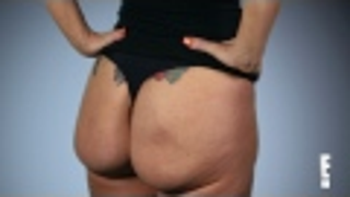 Woman Who Can Literally FLIP Her Butt Implants Goes On <em>Botched</em>
